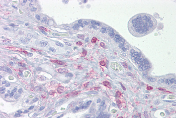 ING3 Rabbit Polyclonal Antibody
