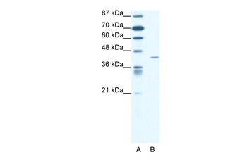 FOXL2 Rabbit Polyclonal Antibody