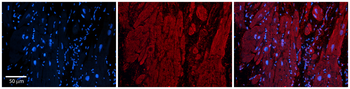 ZFP36L1 Rabbit Polyclonal Antibody