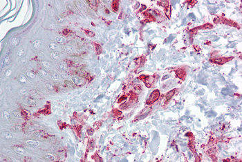 ZFP36L2 Rabbit Polyclonal Antibody
