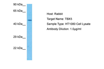 TBX5 Rabbit Polyclonal Antibody