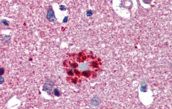 TCF21 Rabbit Polyclonal Antibody