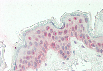 KLF10 Rabbit Polyclonal Antibody