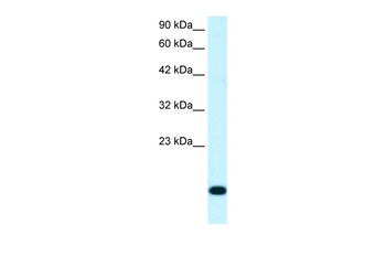 RPS16 Rabbit Polyclonal Antibody