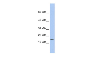 BTG2 Rabbit Polyclonal Antibody