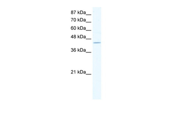 ZNF212 Rabbit Polyclonal Antibody