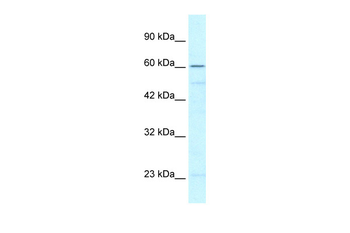 ZNF212 Rabbit Polyclonal Antibody