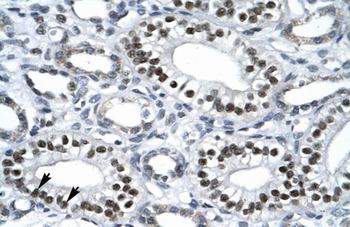 NR1H4 Rabbit Polyclonal Antibody