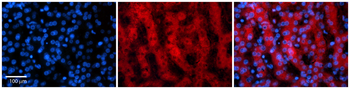 PARP16 Rabbit Polyclonal Antibody