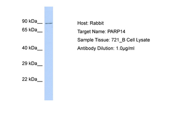 PARP14 Rabbit Polyclonal Antibody