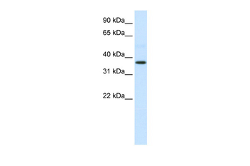 AHSG Rabbit Polyclonal Antibody