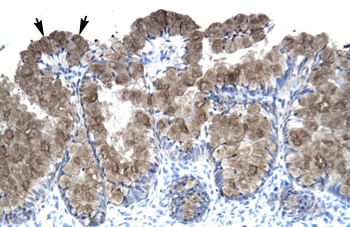 ASGR2 Rabbit Polyclonal Antibody