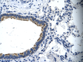 ASGR2 Rabbit Polyclonal Antibody