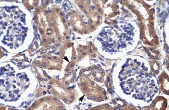 FABP3 Rabbit Polyclonal Antibody