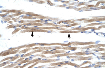 FABP3 Rabbit Polyclonal Antibody