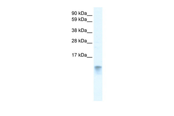 FABP3 Rabbit Polyclonal Antibody