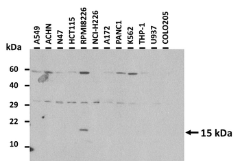 FABP7 Rabbit Polyclonal Antibody
