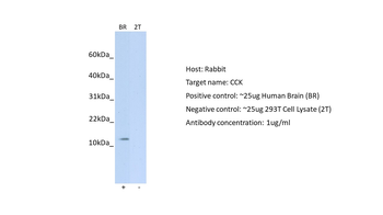 CCK Rabbit Polyclonal Antibody