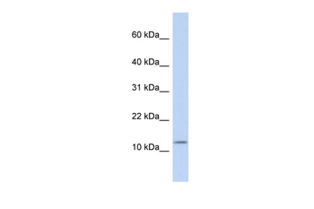 CCK Rabbit Polyclonal Antibody