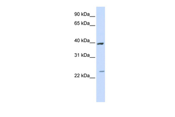 ACADL Rabbit Polyclonal Antibody