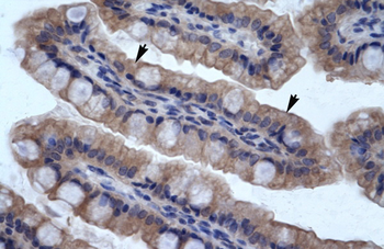 SMPDL3B Rabbit Polyclonal Antibody