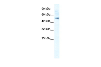 SMPDL3B Rabbit Polyclonal Antibody