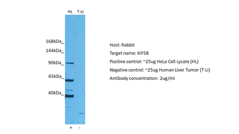 KIF5B Rabbit Polyclonal Antibody