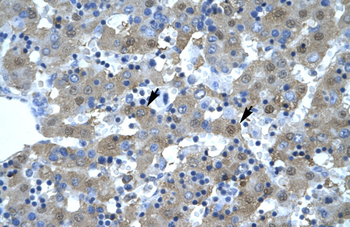 KIF5B Rabbit Polyclonal Antibody