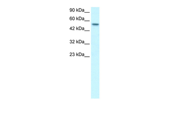 RUNX1T1 Rabbit Polyclonal Antibody