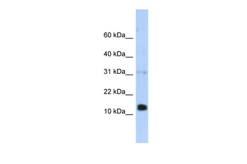 REG1B Rabbit Polyclonal Antibody