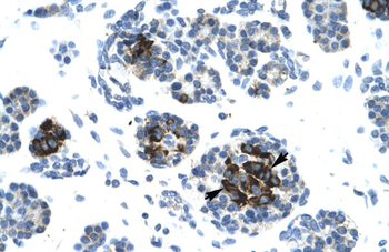 LIG4 Rabbit Polyclonal Antibody