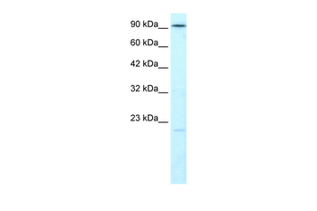 LIG4 Rabbit Polyclonal Antibody