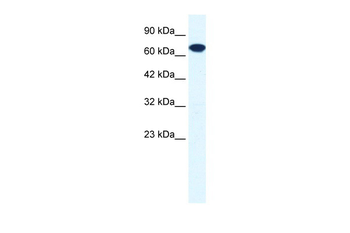 ZNF179 Rabbit Polyclonal Antibody