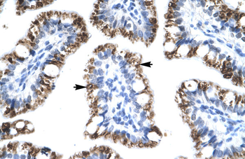 ATF2 Rabbit Polyclonal Antibody