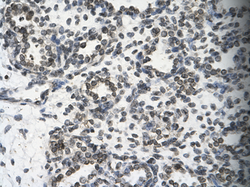 SMARCB1 Rabbit Polyclonal Antibody
