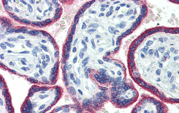 ASH2L Rabbit Polyclonal Antibody
