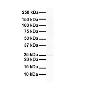 RNF2 Rabbit Polyclonal Antibody