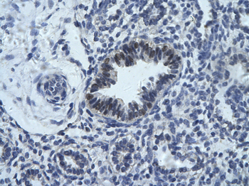 RCOR1 Rabbit Polyclonal Antibody