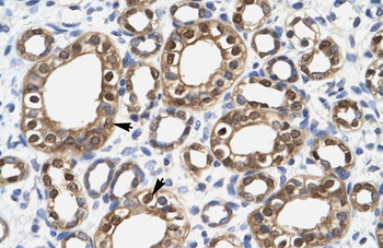 ENO1 Rabbit Polyclonal Antibody
