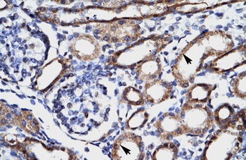 FHL1 Rabbit Polyclonal Antibody