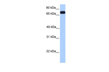 PRICKLE3 Rabbit Polyclonal Antibody
