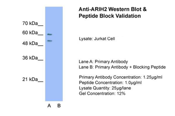 ARIH2 Rabbit Polyclonal Antibody