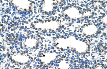 ARIH2 Rabbit Polyclonal Antibody