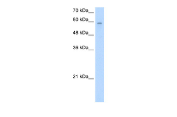 ARIH2 Rabbit Polyclonal Antibody