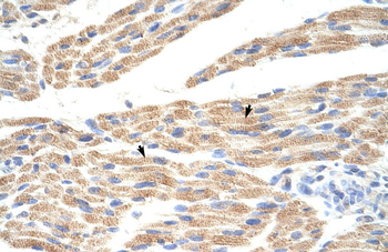 TNRC5 Rabbit Polyclonal Antibody