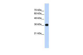 TNRC5 Rabbit Polyclonal Antibody