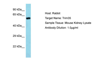 Trim35 Rabbit Polyclonal Antibody