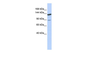 TRIM24 Rabbit Polyclonal Antibody