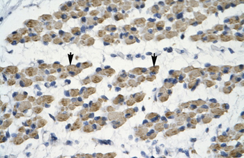 TRIM68 Rabbit Polyclonal Antibody