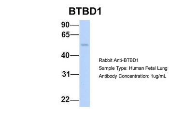 BTBD1 Rabbit Polyclonal Antibody